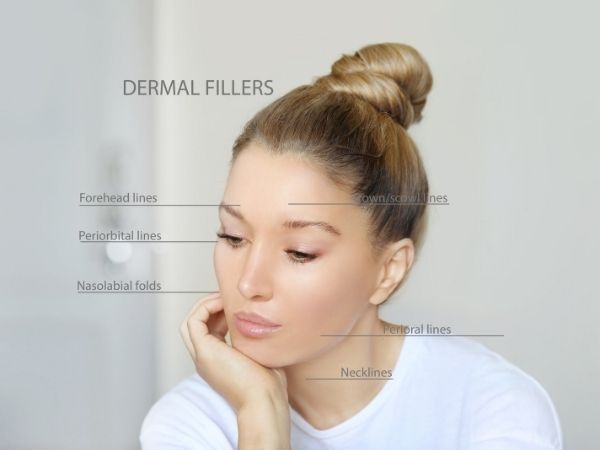 dermal fillers milton keynes